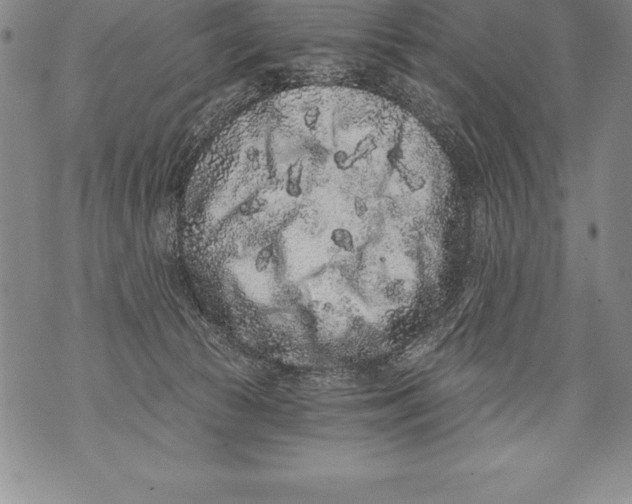 X0000076100177200610152352