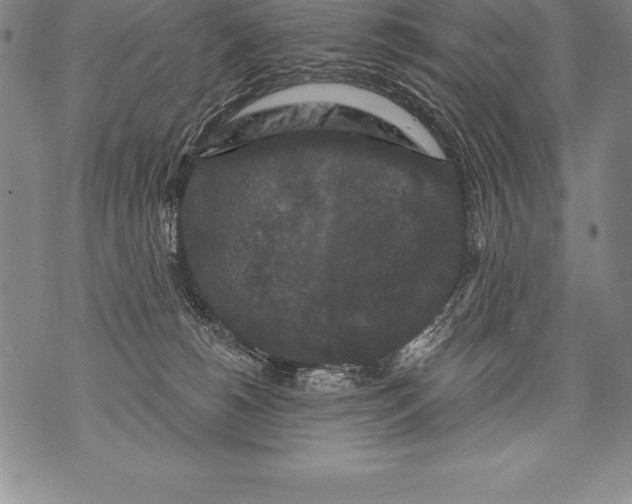 X0000076100180200610152352