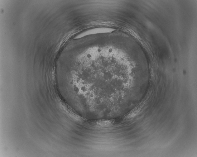 X0000076100357200610152349