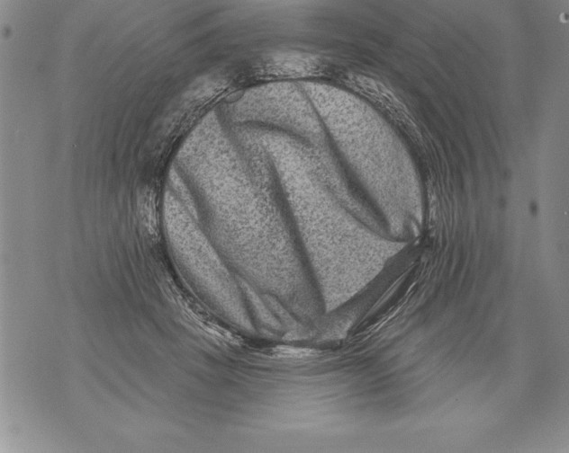 X0000076100457200610152348