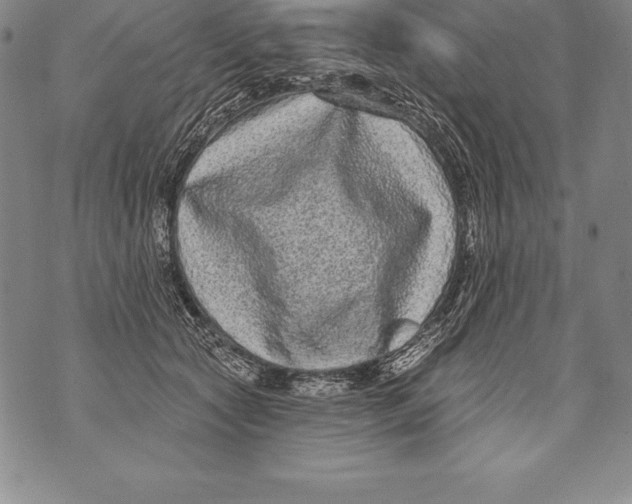 X0000076100561200610152346