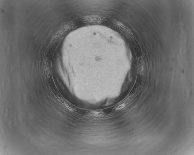 X0000076100573200610152346