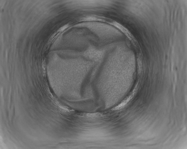 X0000076100857200610152341