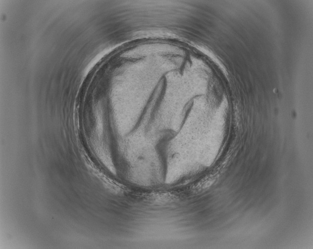 X0000076100983200610152339