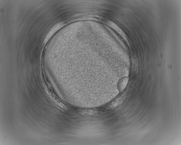 X0000076101002200610152339