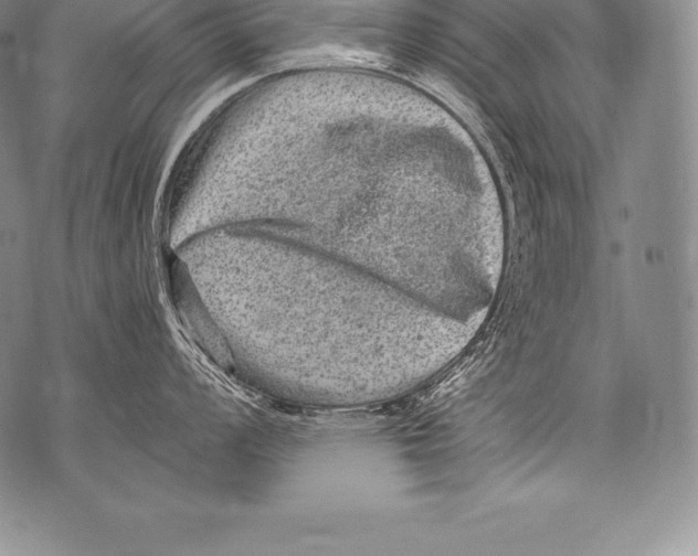 X0000076101008200610152338