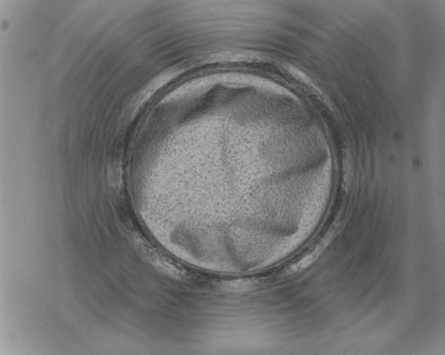 X0000076101017200610152338