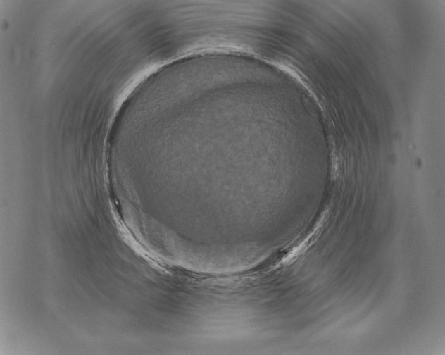 X0000076101038200610152338