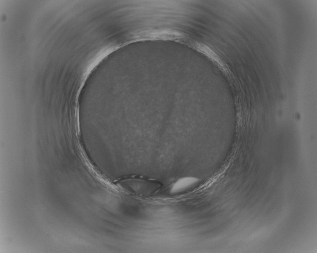 X0000076101079200610152337