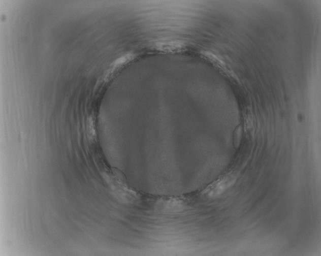 X0000076101106200610152336