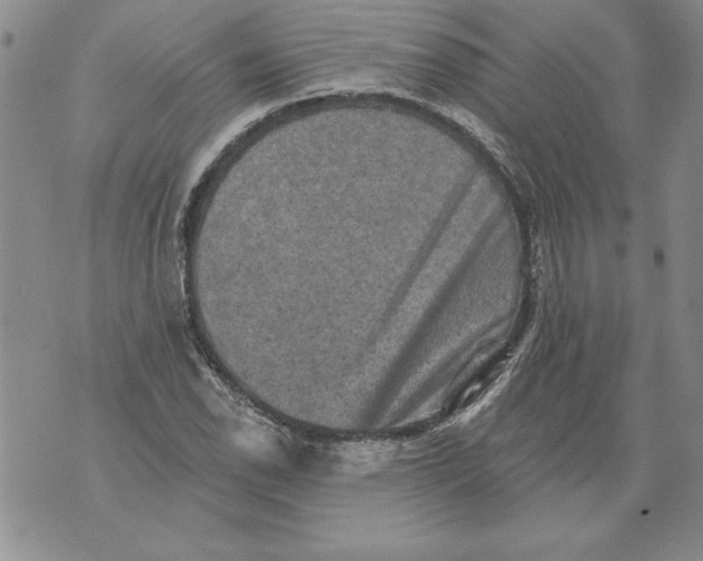 X0000076101118200610152336