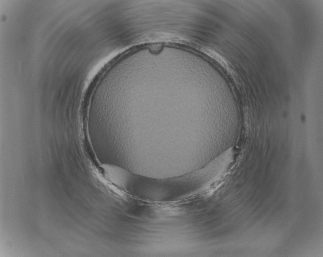 X0000076101120200610152336