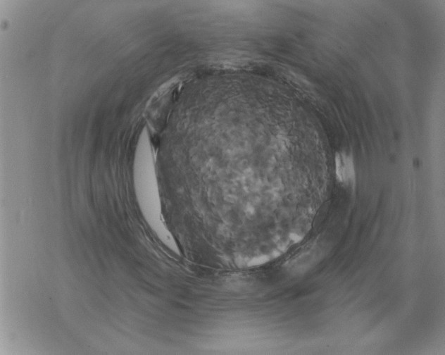 X0000076101155200610152336