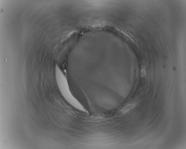 X0000076101156200610152336