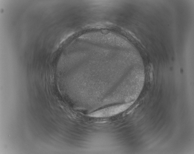 X0000076101158200610152336