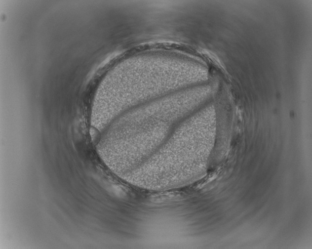 X0000076101159200610152336