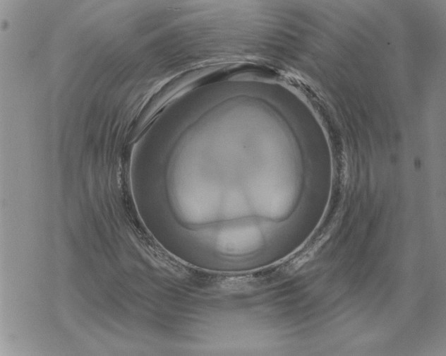 X0000076101161200610152336