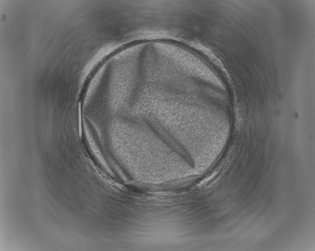 X0000076101175200610152336