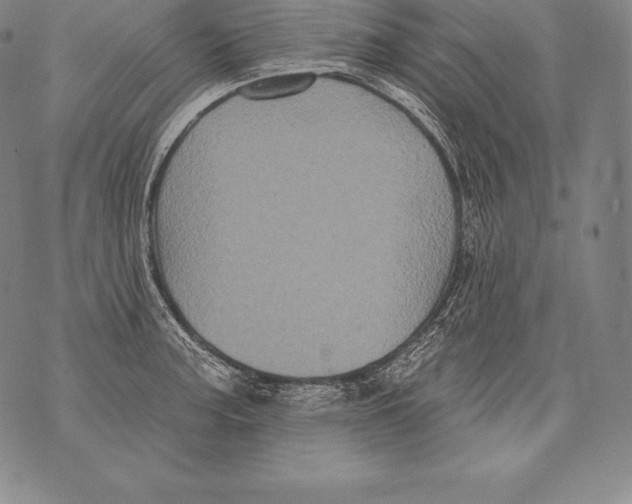 X0000076101187200610152336