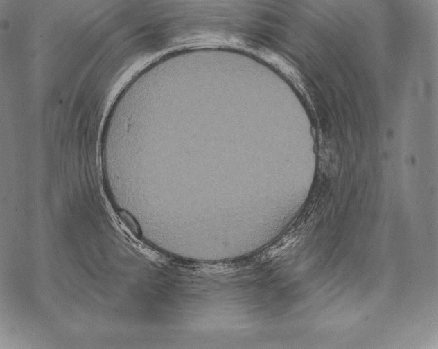 X0000076101191200610152336