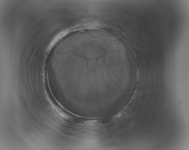 X0000076100054200610202146