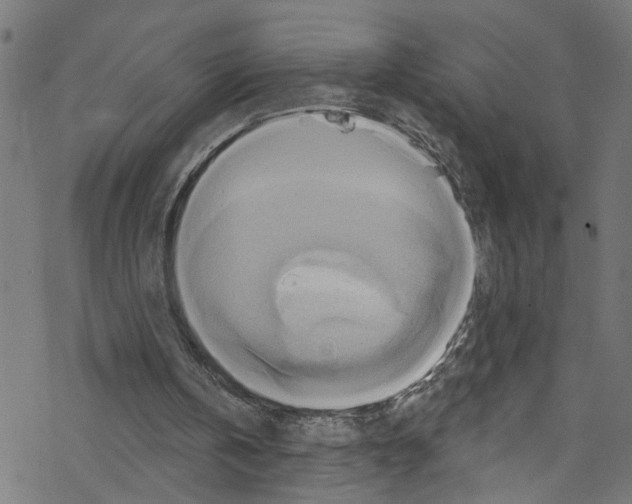 X0000076220146200611161008
