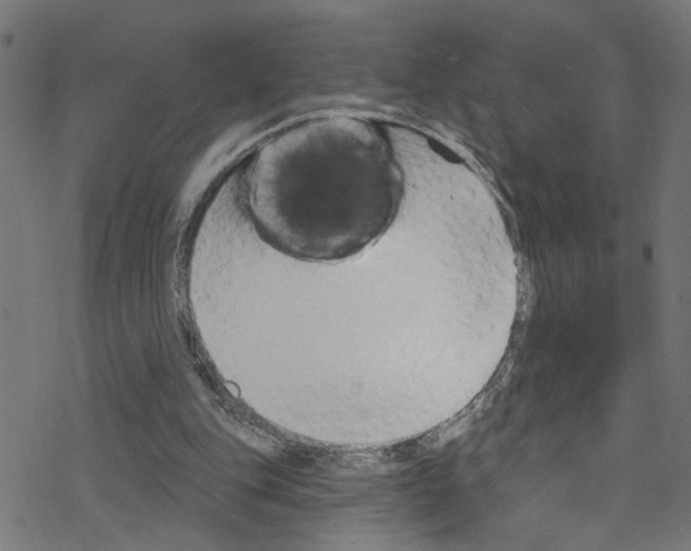X0000076220151200611161008