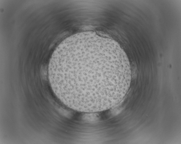 X0000076220179200611161008