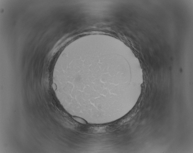 X0000076220295200611161006