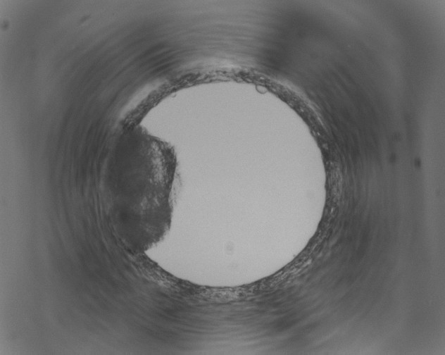 X0000076220871200611160956