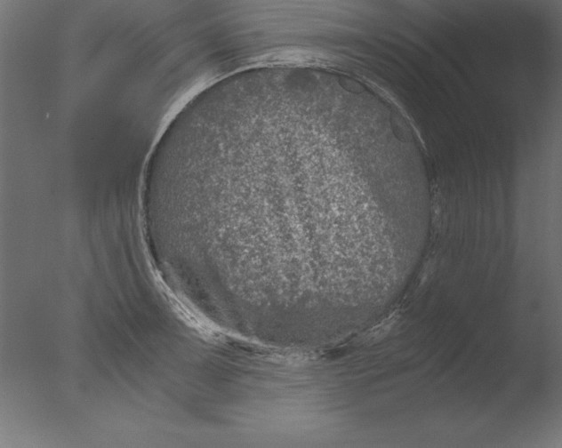 X0000076311091200610201606