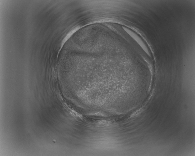 X0000076311097200610201606