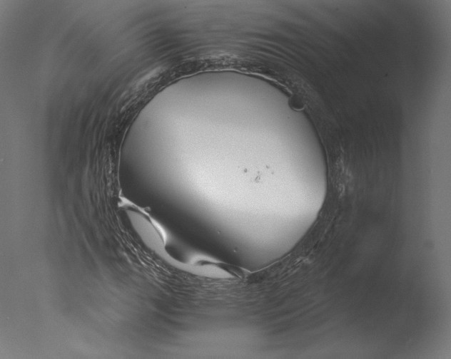 X0000076311111200610201605