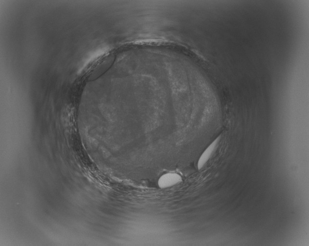 X0000076311351200610201602