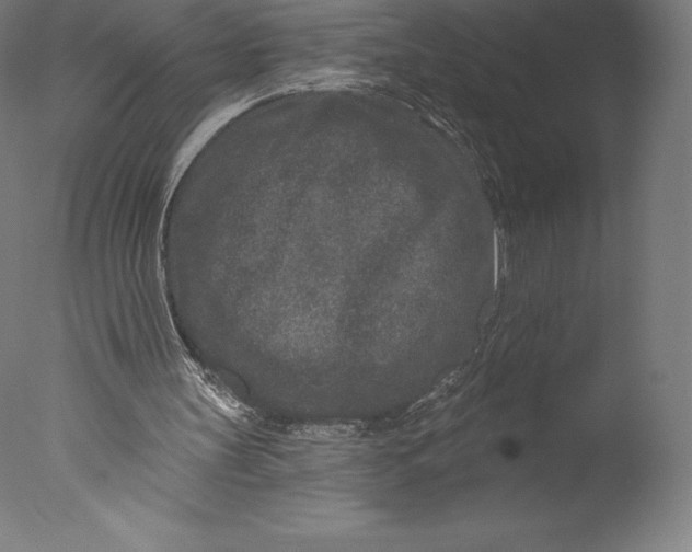 X0000076320147200610201647