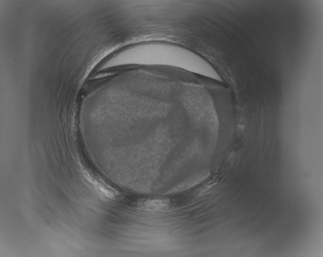 X0000076320156200610201648