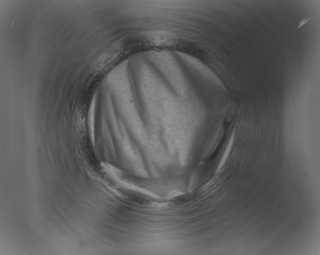 X0000076320176200610201648