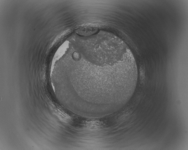 X0000076330396200610201710