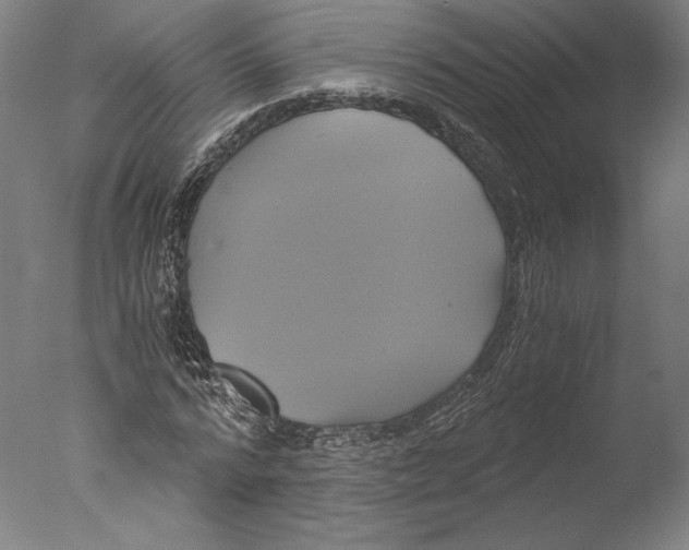 X0000076330776200610201704