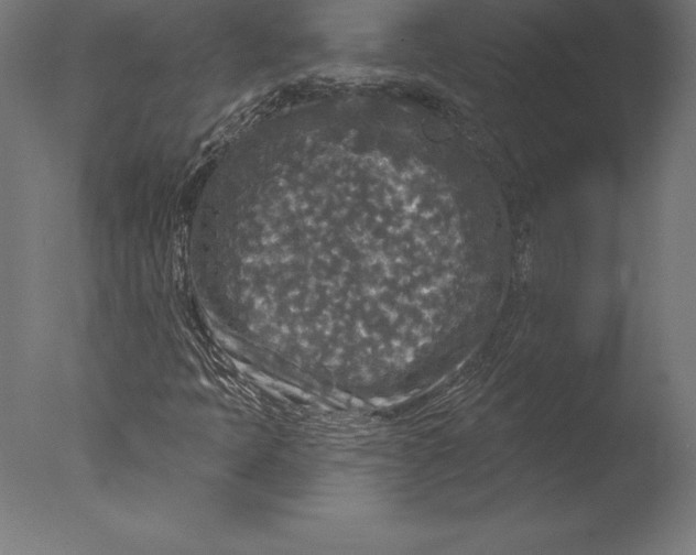 X0000076341397200610201718