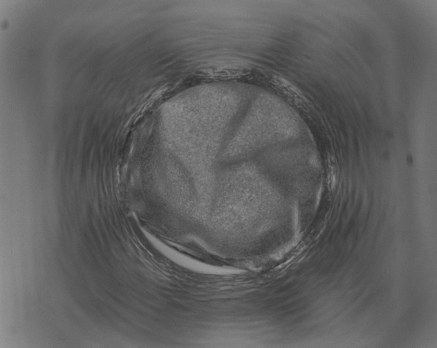 X0000076351108200610161752