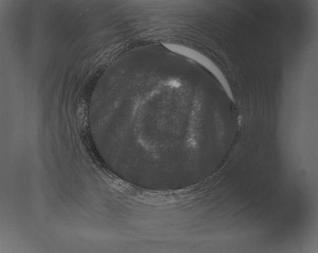 X0000076350029200610201812