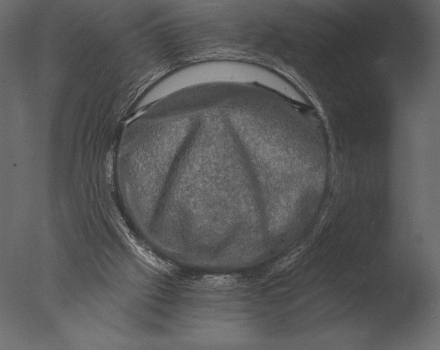 X0000076350057200610201811