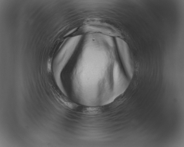 X0000076350095200610201811