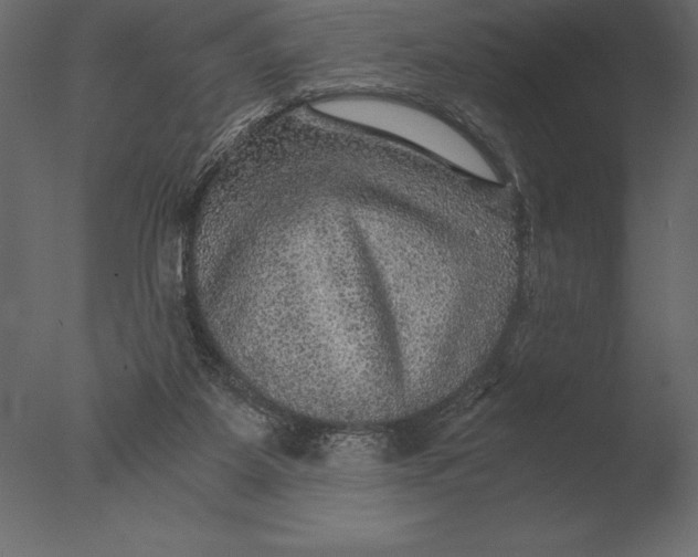 X0000076350115200610201810