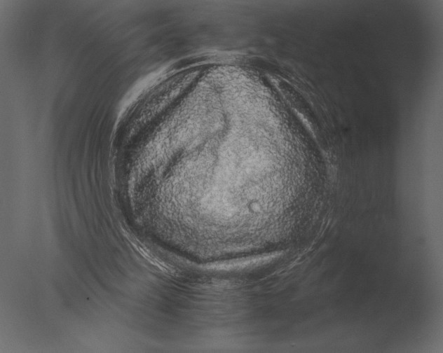 X0000076350149200610201809