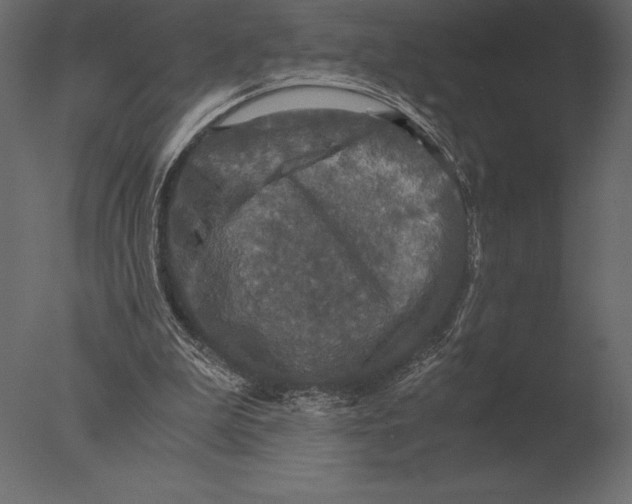 X0000076350199200610201809