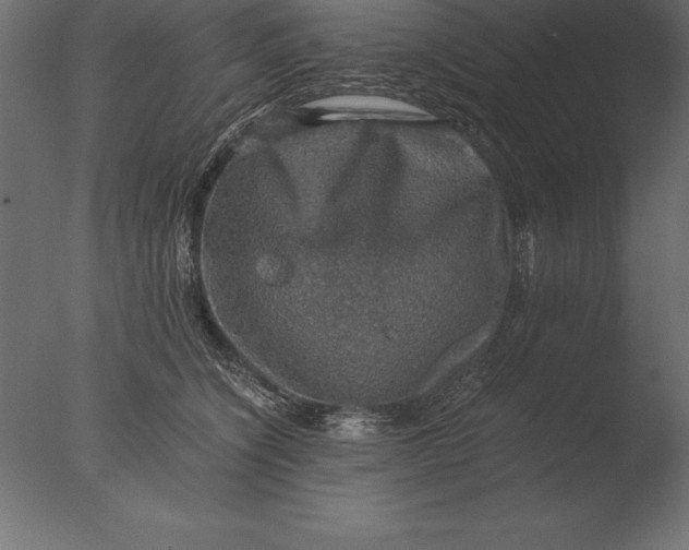 X0000076350564200610201803