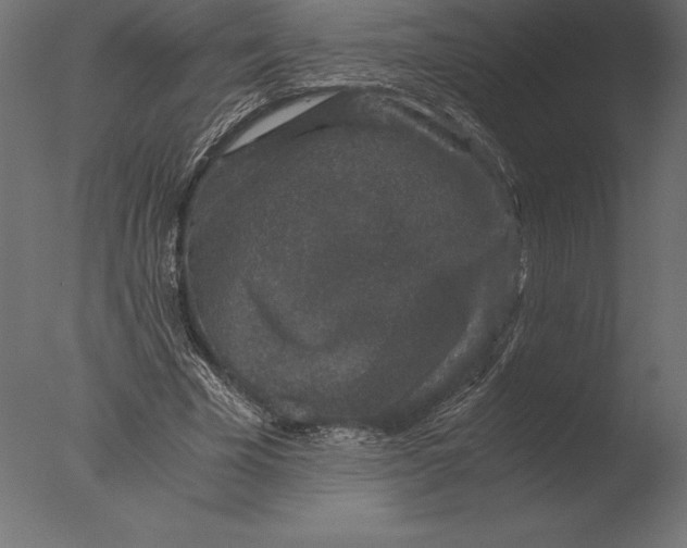 X0000076350585200610201802