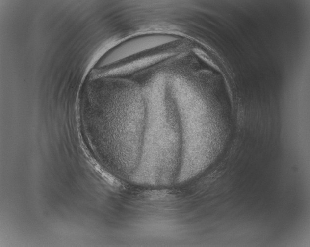 X0000076350990200610201755